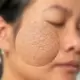 Kremas reguliuojantis veido odos sebumo išsiskyrimą